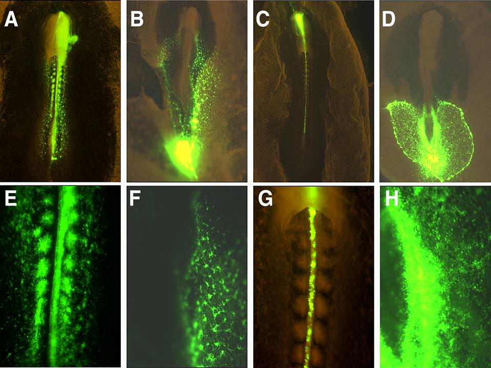 Gene transfection for tissues other than CNS